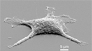 An electron microscope view of a zombie cell.