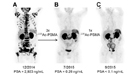 This picture shows three different images of a single patient with end-stage prostate cancer. 