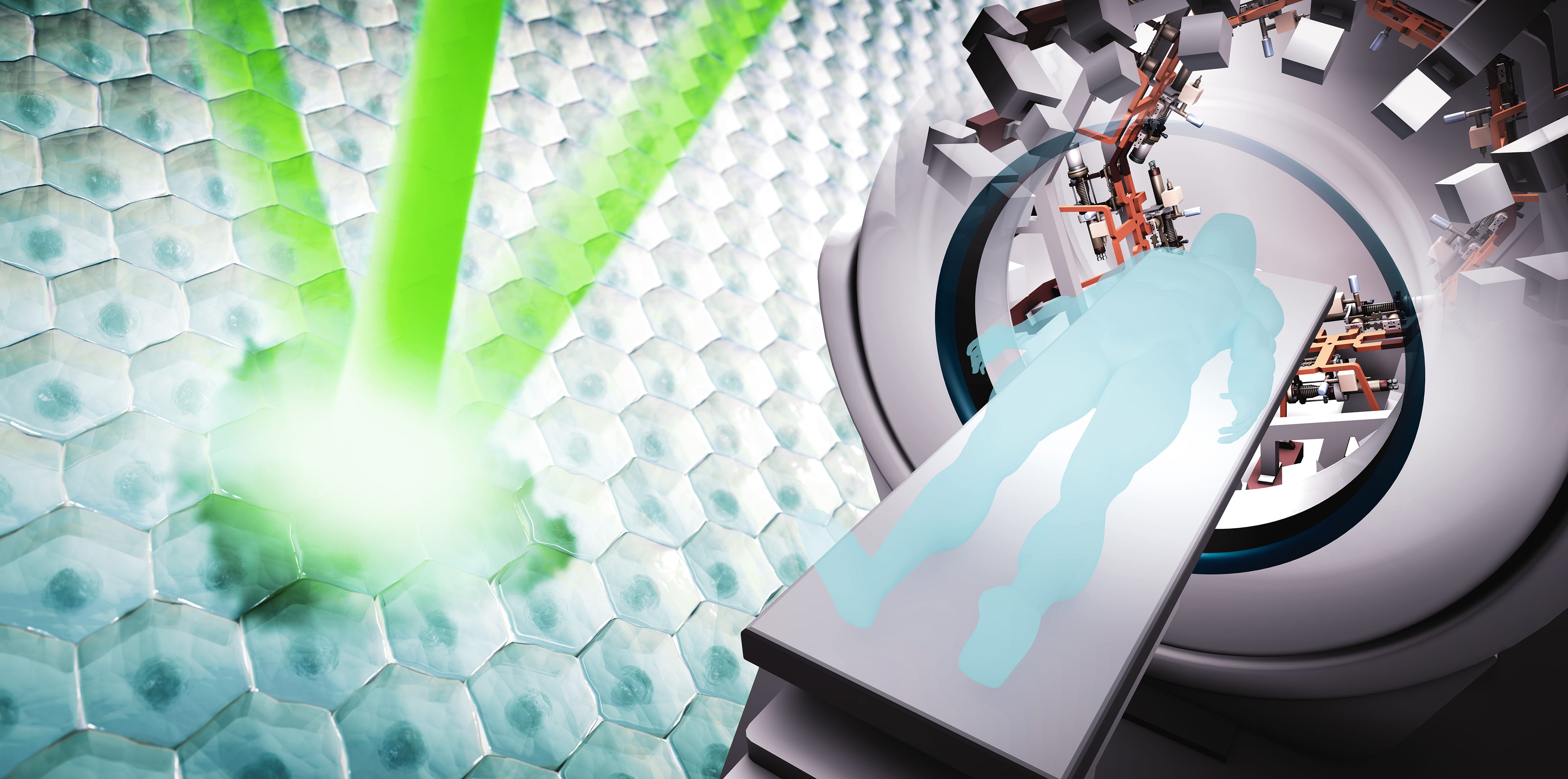 Radiation Therapy