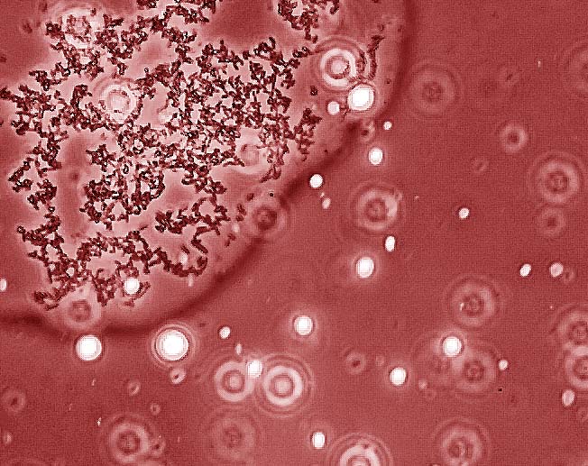 Microscopic image of E. coli