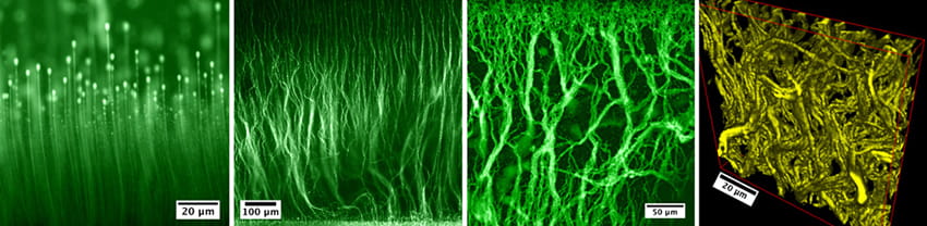Control of the synthesis results in a diversity of self-assembled structures formed by sticky colloidal particles:  array of “mushrooms” (left), wavy colloidal “fur”, dense fiber network, and three-dimensional reconstruction of the network (right).